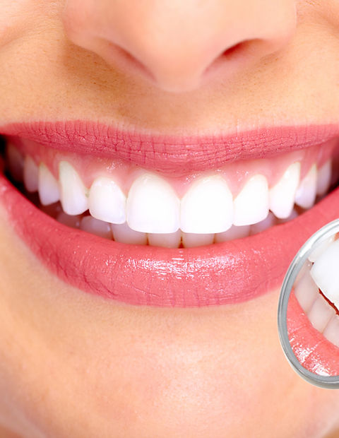 Perfect Smile