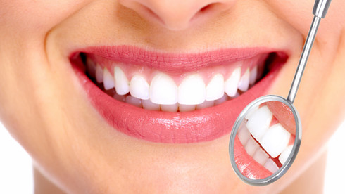 ZAHNREINIGUNG & BLEACHING