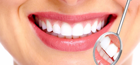Perfect Smile
