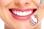 Perfect Smile