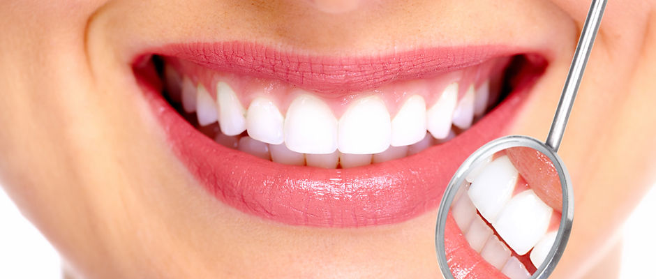 Perfect Smile