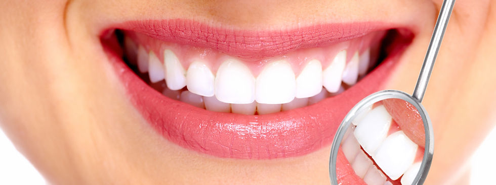Perfect Smile