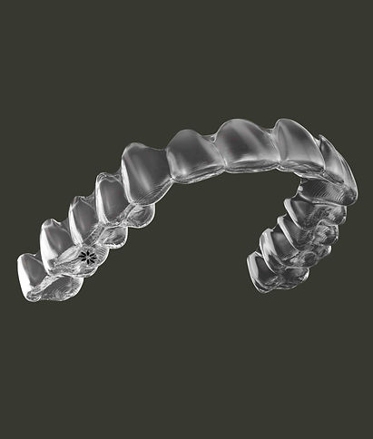 Upper Aligner