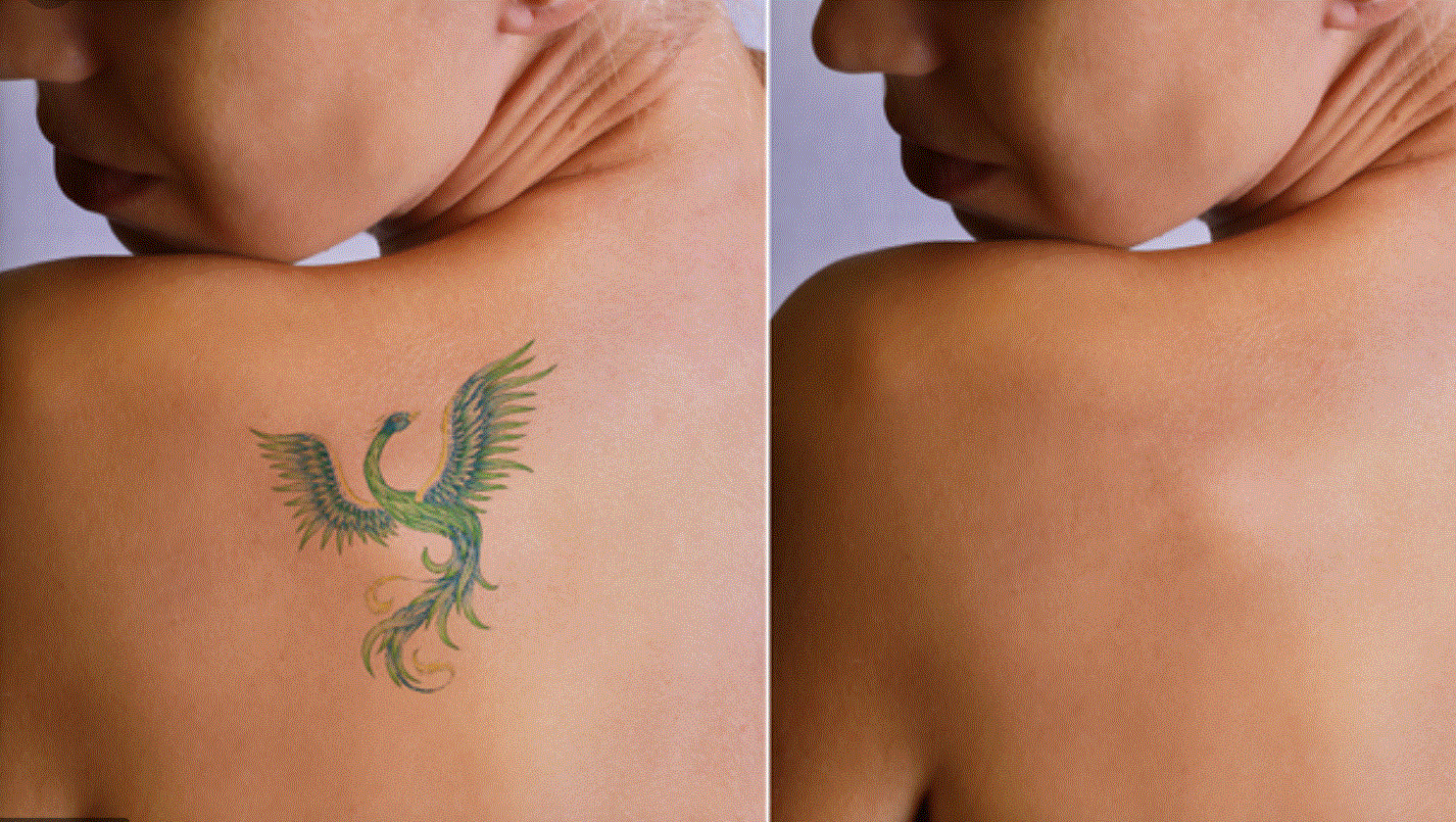 BnA Back Dragon.GIF