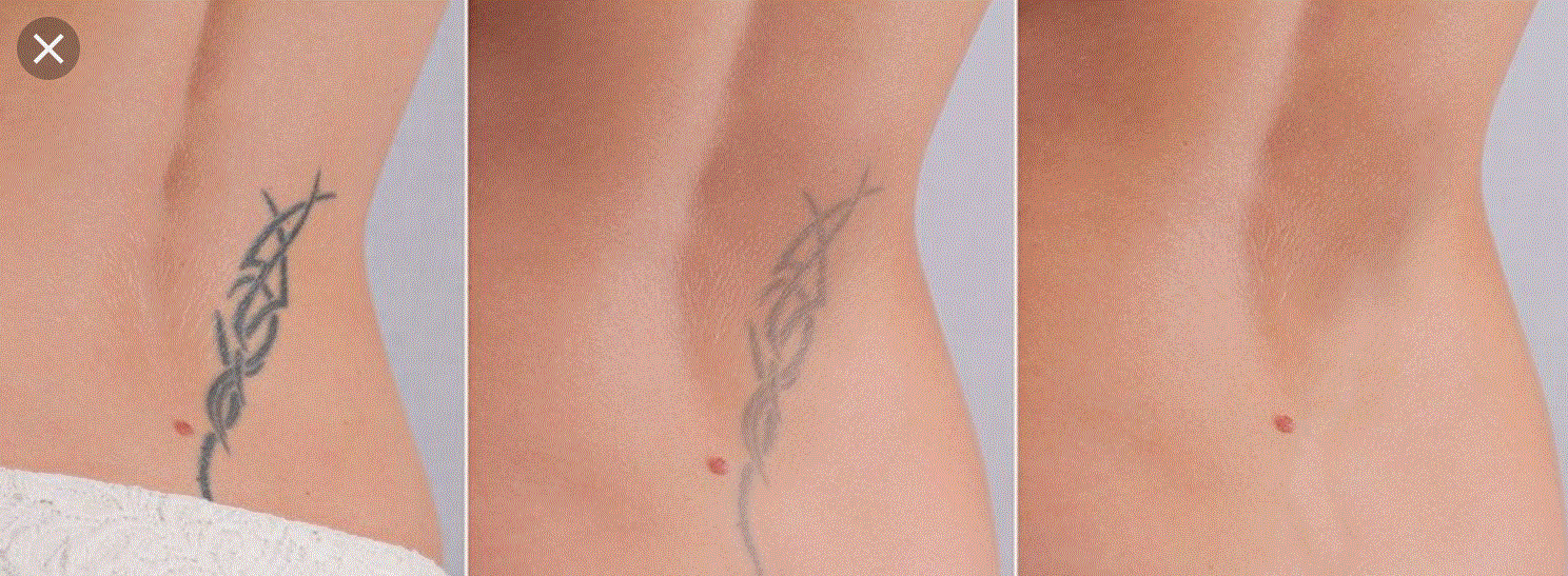 BnA Lower Back Tribal.GIF