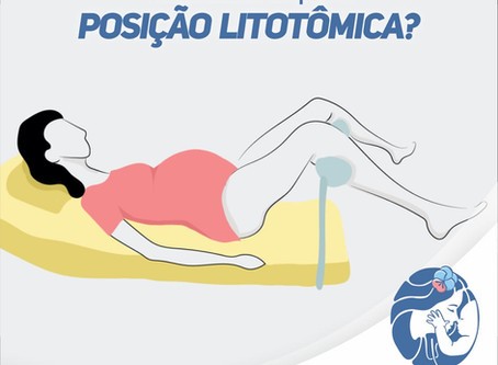 Você sabe o que é posição litotômica?