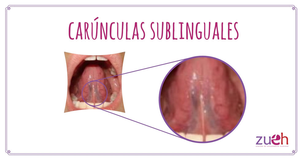 HABLEMOS SOBRE EL FRENILLO LINGUAL