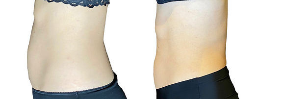 Em Shape AYA Maison de Beauté