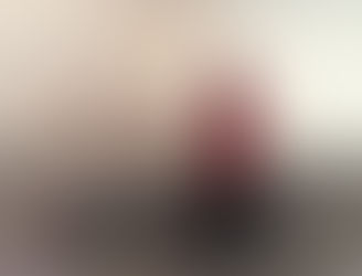 Get the 'Kylie Jenner' lips