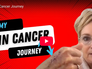 Squamous Cell Carcinoma It Could Happen to You