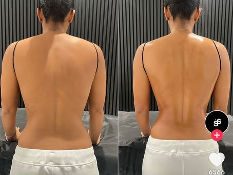 Madero-Massage – was dahinter steckt und warum gerade alle darüber sprechen