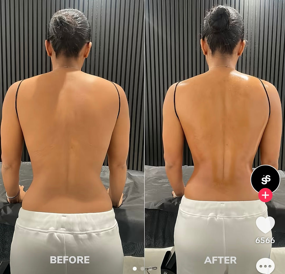 Madero-Massage – was dahinter steckt und warum gerade alle darüber sprechen