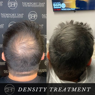 Density Treatment SMP