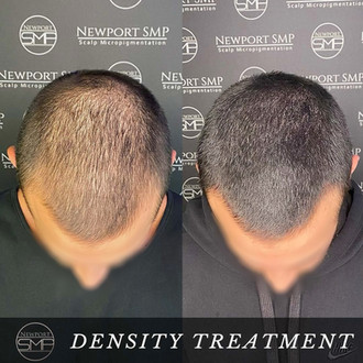 Density Treatment SMP