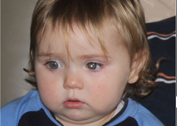 White reflect or glow in left pupil