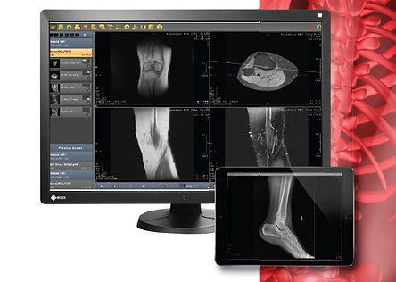 DelMedical_EvoView-PACS.jpg