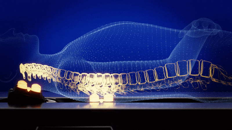 Migun床脊柱效果视频