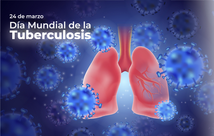 24 de marzo: Día Mundial de la Tuberculosis