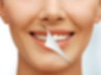 Tooth whitening
