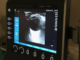 Day 18: Eye Spy With My Little Eye...