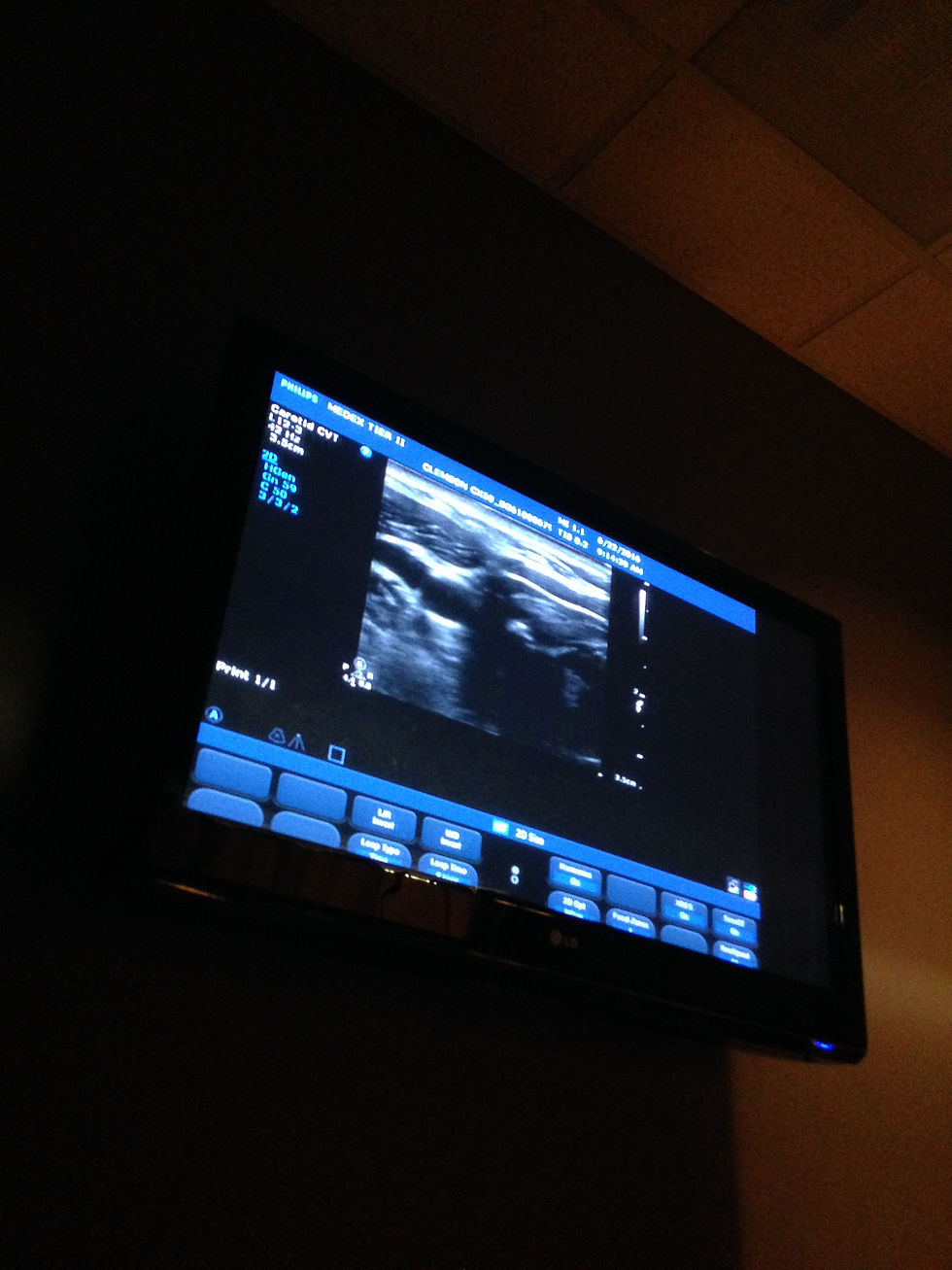 That's inside my neck?!?!