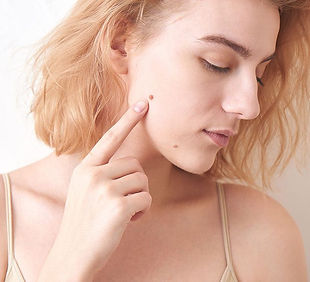 woman-mole-face.jpg