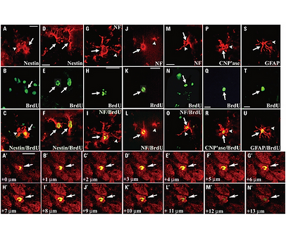 Cellular Response of Ventricular-Subventricular Neural ProgenitorStem Cells to Neonatal Hy