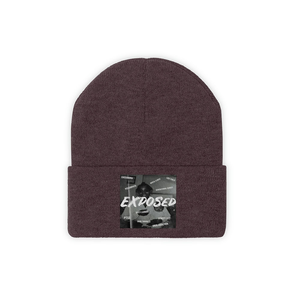 Thumbnail: Exposed Knit Beanie
