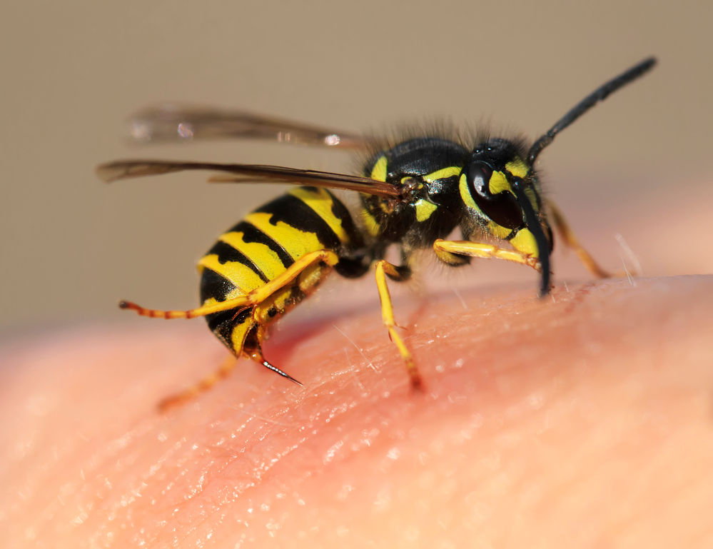Natural Remedies For Wasp Sting Naturally Remedy