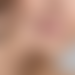 Lūpų odos priežiūra