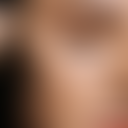 Apie stebukladarį retinolį