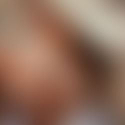 Gydytoja įspėja: tai gali sukelti odosvėžio protrūkį