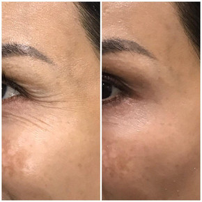 Anti Wrinkle 14.jpeg