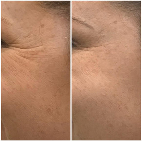 Anti Wrinkle 4.jpeg