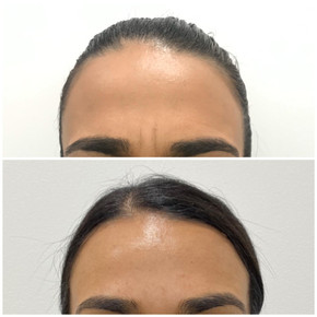 Anti Wrinkle 8.jpeg