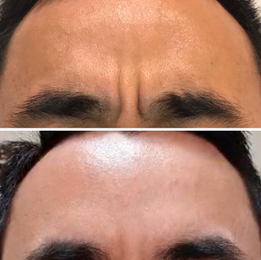 Anti Wrinkle 17.jpeg
