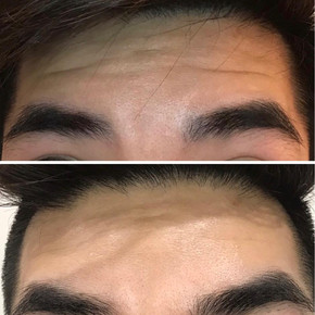 Anti Wrinkle 2.jpeg