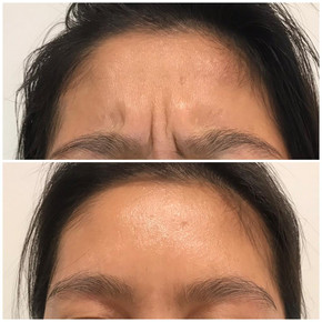 Anti Wrinkle 13.jpeg