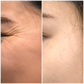 Anti Wrinkle 12.jpeg