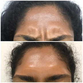 Anti Wrinkle 5.jpeg