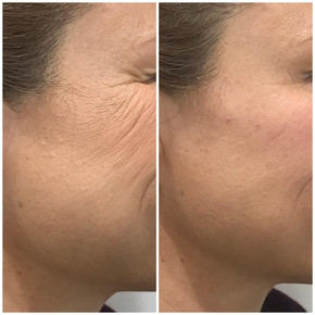Anti Wrinkle 11.jpeg