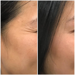 Anti Wrinkle 6.jpeg