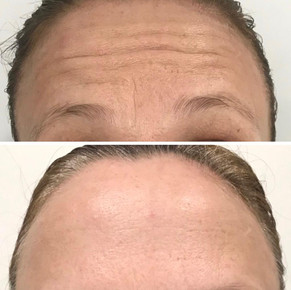 Anti Wrinkle 3.jpeg