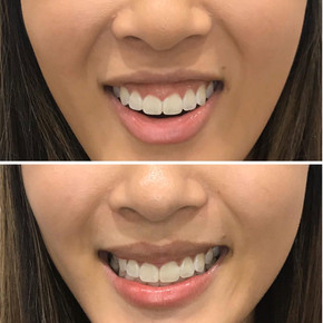 Anti Wrinkle 16.jpeg