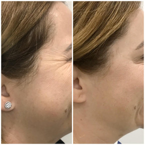 Anti Wrinkle 9.jpeg