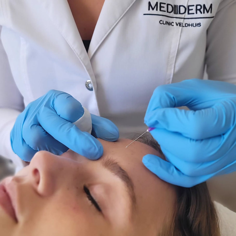 Mediderm Clinic - Acne Treatment.jpeg