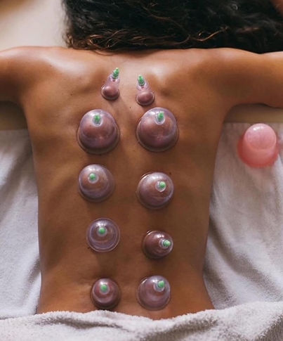 cupping