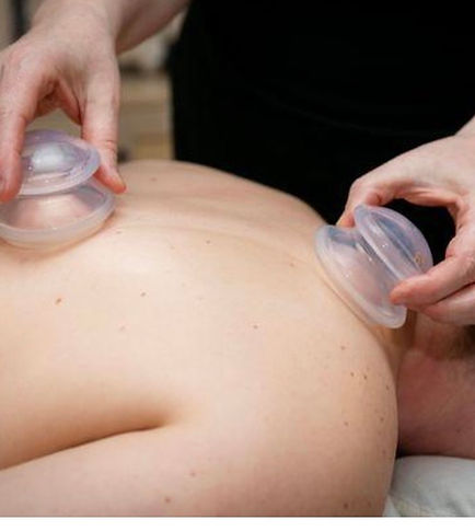 CUPPING