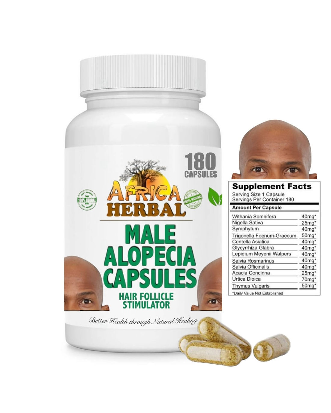 MALE ALOPECIA REMEDY CAPSULES