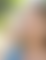 About Allergy Testing